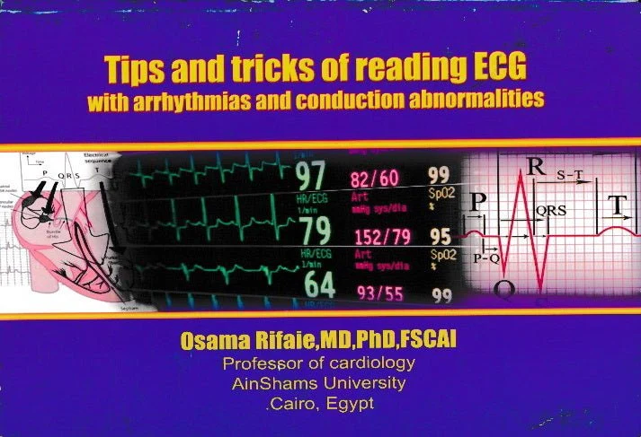 Tips and Tricks of Reading ECG: With arrhythmias and Conduction Abnormalities - Image 7