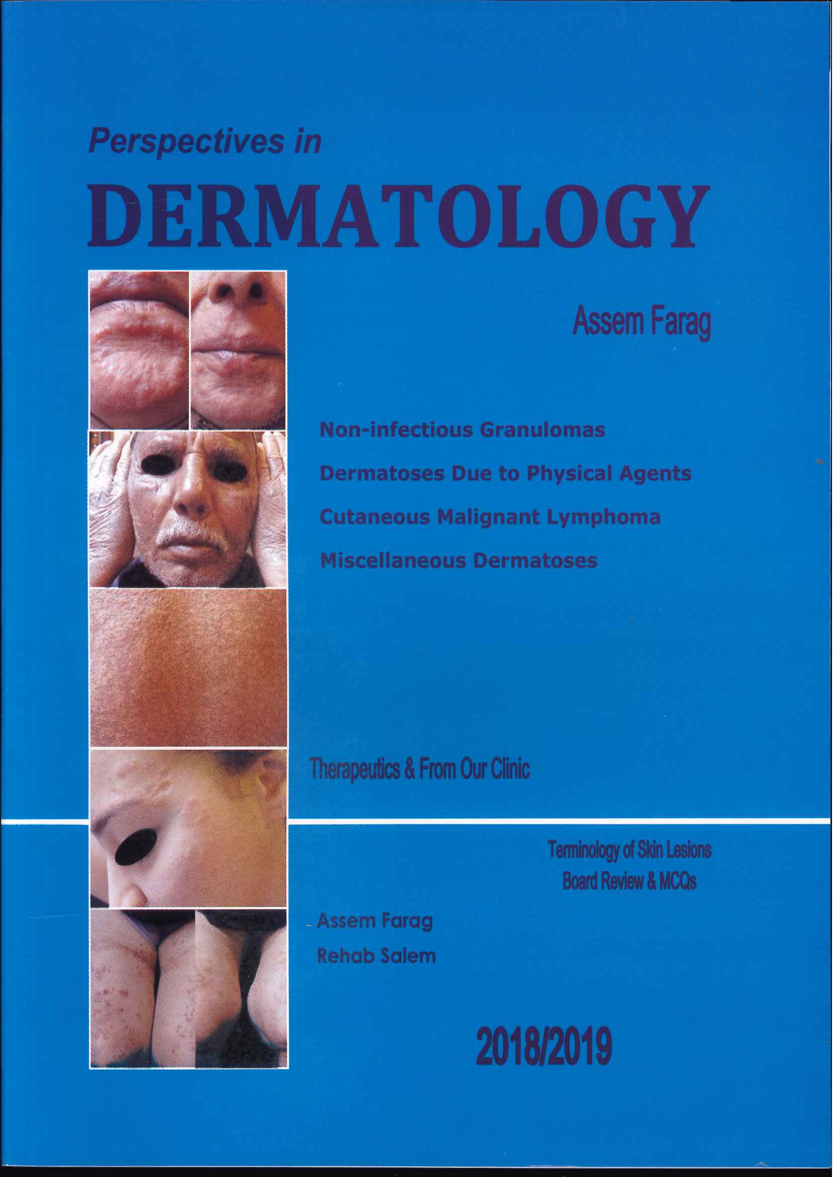 Perspectives in Dermatology: Non-infectious Granulomas Dermatoses Due to Physical Agents Cutaneous Malignant Lymphoma Miscellaneous Dermatoses - Image 24
