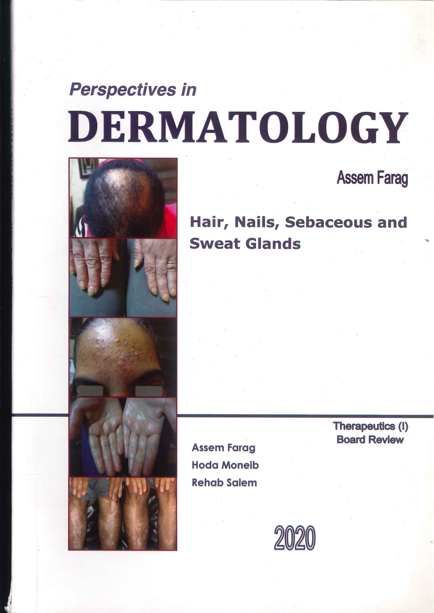 Perspectives in Dermatology: Hairs, Nails, Sebaceous and Sweat Glands - Image 13