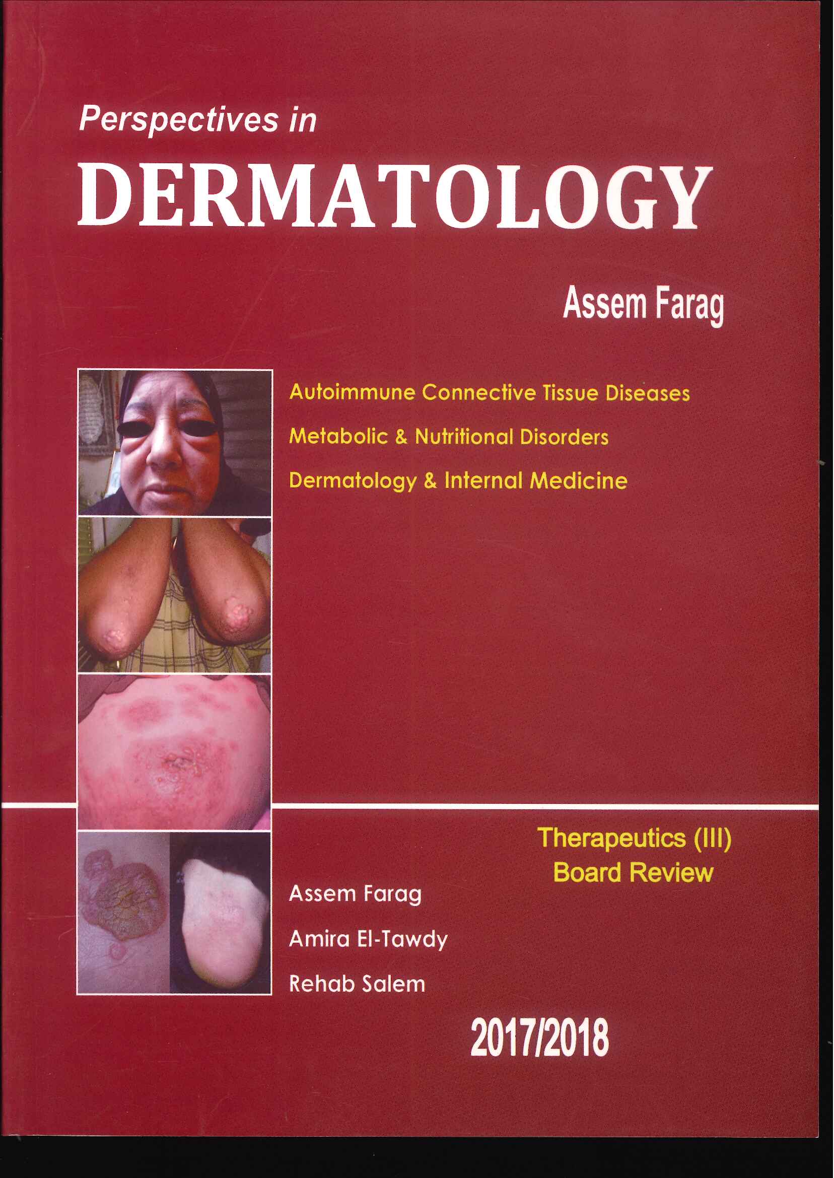 Perspectives in Dermatology: Autoimmune Connective Tissue Diseases Metabolic & Nutritional Disorders Dermatology & Internal Medicine - Image 5