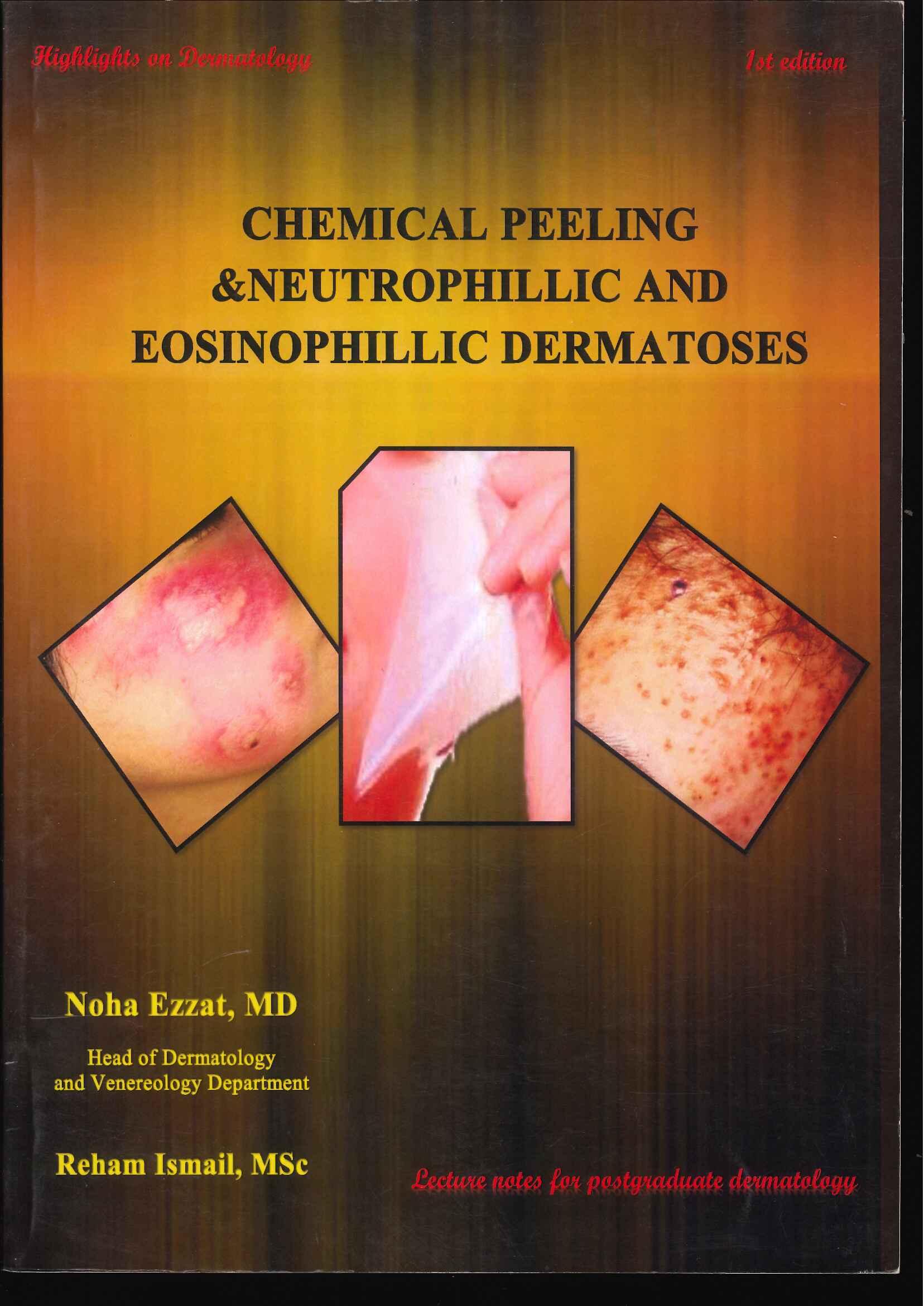 Highlights on Dermatology: Chemical Peeling & Neutrophillic and Eosinophillic Dermatoses - Image 27
