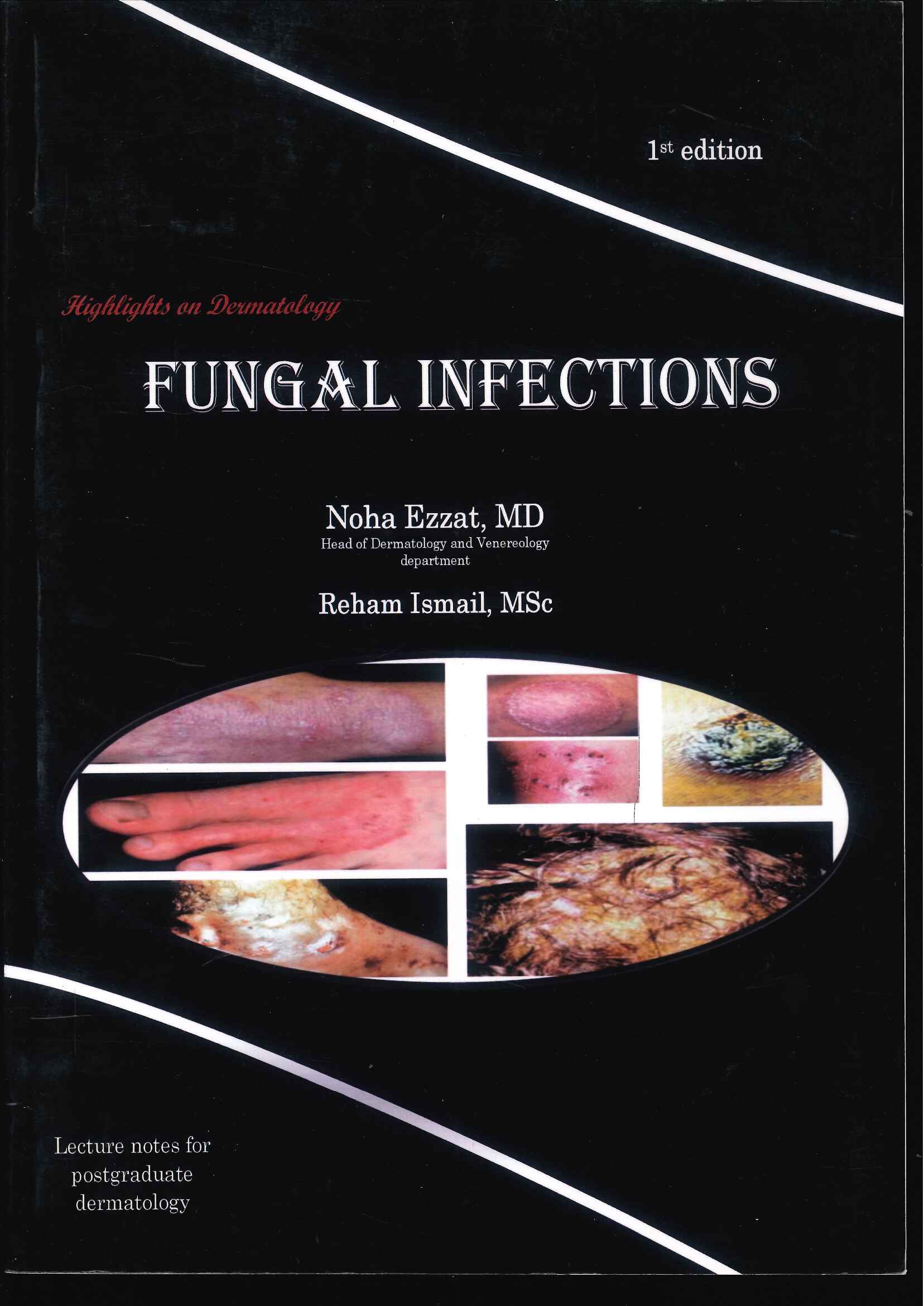 Highlights on Dermatology: Fungal Infections - Image 18