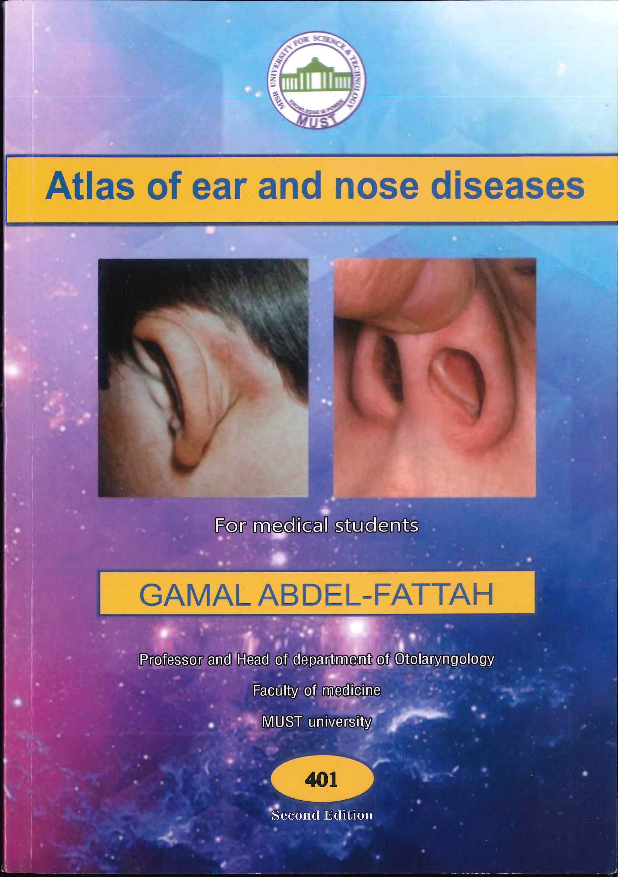 Atlas of Ear and Nose Diseases for Medical Students 401, 2e - Image 2