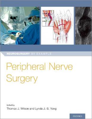 Peripheral Nerve Surgery - Image 2