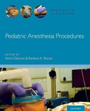 Pediatric Anesthesia Procedures - Image 13