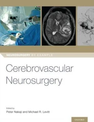 Cerebrovascular Neurosurgery - Image 40
