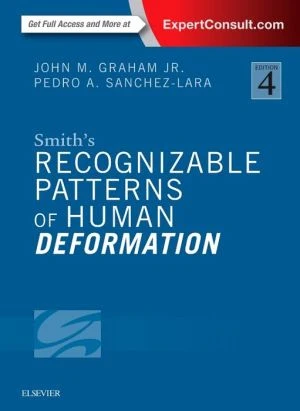 Smith's Recognizable Patterns of Human Deformation, 4e** - Image 27