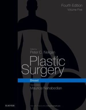 Plastic Surgery: Volume 5: Breast, 4e** - Image 4