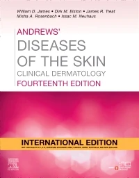 Andrews' Diseases of the Skin: Clinical Dermatology (IE), 14e