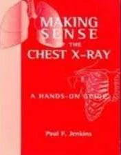 Making Sense of the Chest X-ray : A hands-on guide** - Image 26