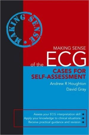 Making Sense of the ECG: Cases for Self-assessment** - Image 30