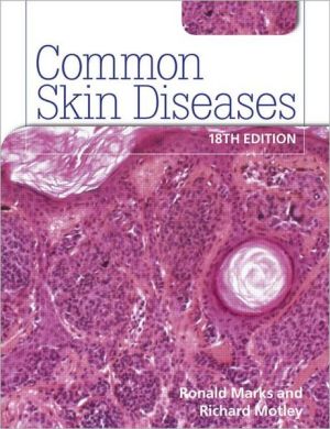 Common Skin Diseases, 18e - Image 40