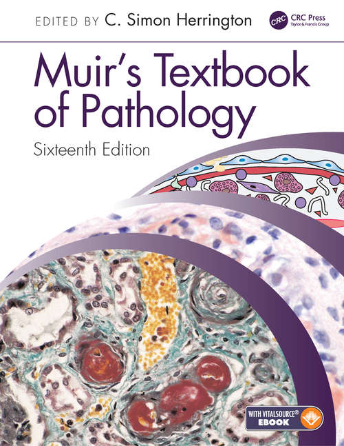 Muir's Textbook of Pathology, 16e - Image 16