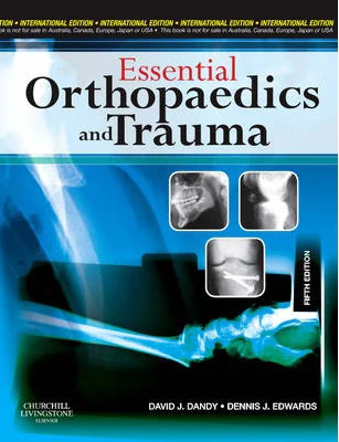 Essential Orthopaedics and Trauma, With STUDENT CONSULT Online Access, 5e - Image 20