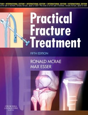 Practical Fracture Treatment (IE), 5e - Image 29