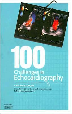 100 Challenges in Echocardiography ** - Image 13