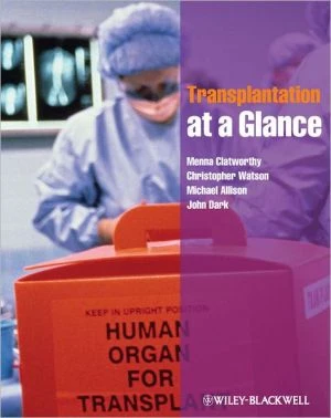 Transplantation at a Glance - Image 2