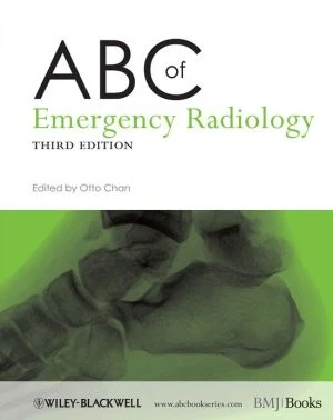 ABC of Emergency Radiology, 3e - Image 34