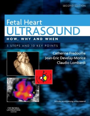 Fetal Heart Ultrasound, How, Why and When, 2e ** - Image 8