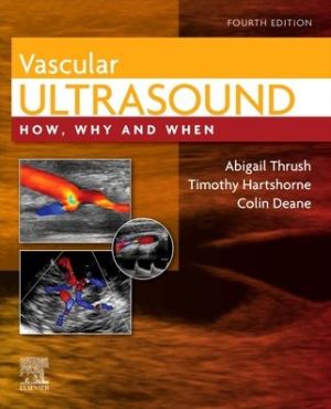 Vascular Ultrasound: How, Why and When, 4e - Image 2