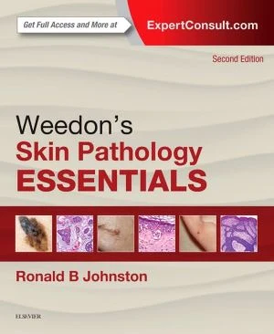 Weedon's Skin Pathology Essentials, 2e** - Image 18