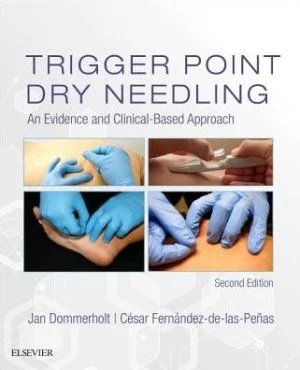 Trigger Point Dry Needling: An Evidence and Clinical-Based Approach, 2e - Image 45