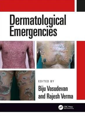 Dermatological Emergencies - Image 24
