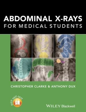 Abdominal X-rays for Medical Students - Image 35