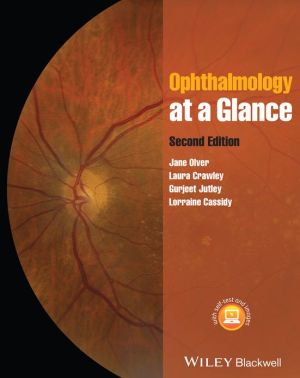 Ophthalmology at a Glance - Image 35