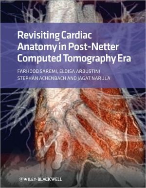 Revisiting Cardiac Anatomy: A Computed-Tomography-Based Atlas and Reference - Image 48
