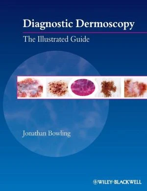 Diagnostic Dermoscopy: The Illustrated Guide** - Image 7