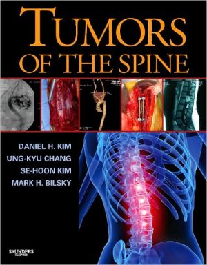 Tumors of the Spine ** - Image 39
