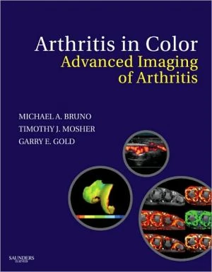 Arthritis in Color: Advanced Imaging of Arthritis - Image 11