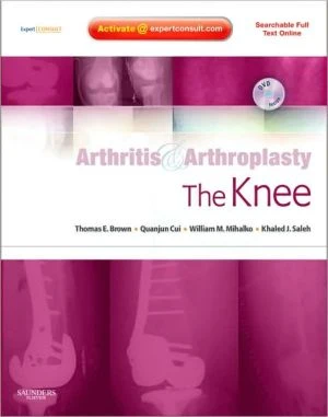 Arthritis and Arthroplasty: The Knee: Expert Consult: Online, Print and DVD ** - Image 46