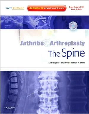 Arthritis and Arthroplasty: The Spine ** - Image 33
