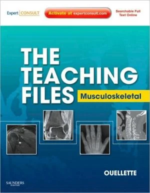 The Teaching Files: Musculoskeletal ** - Image 6