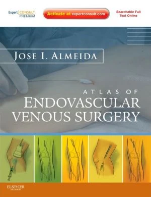 Atlas of Endovascular Venous Surgery: Expert Consult - Online and Print** - Image 24