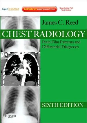 Chest Radiology, 6e ** - Image 7