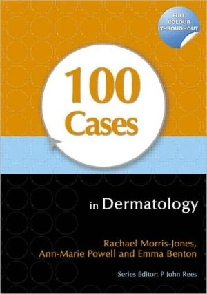 100 Cases in Dermatology - Image 16