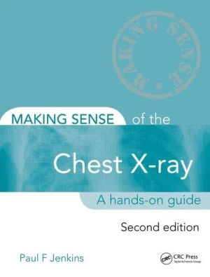 Making Sense of the Chest X-Ray, 2e - Image 41