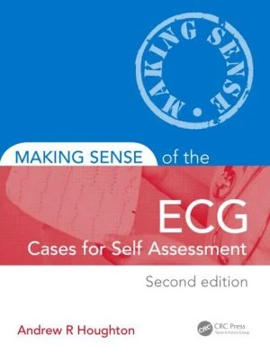 Making Sense of the ECG: Cases for Self Assessment, 2e - Image 28