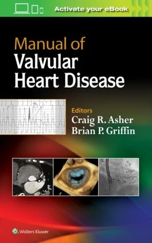 Manual of Valvular Heart Disease** - Image 14