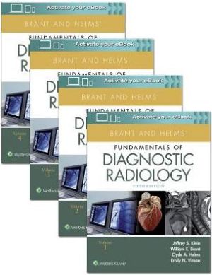 Brant and Helms' Fundamentals of Diagnostic Radiology, 4-Volume Set, 5e-PB** - Image 14