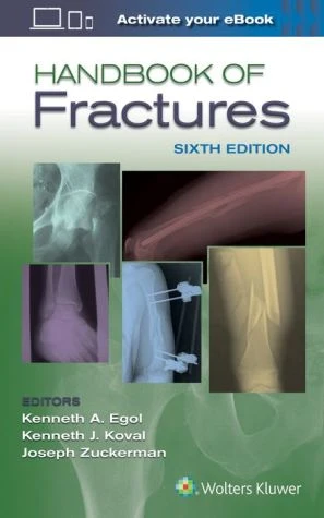 Handbook of Fractures, 6e** - Image 4