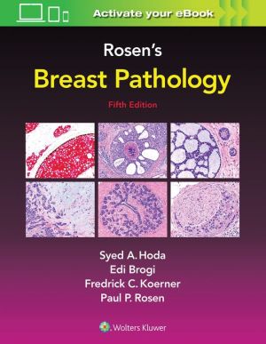 Rosen's Breast Pathology, 5e - Image 17