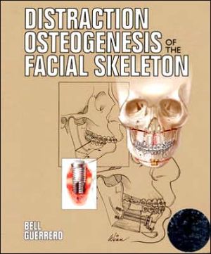 Distraction Osteogenesis of the Facial Skeleton - Image 7