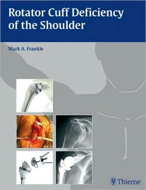 Rotator Cuff Deficiency of the Shoulder - Image 5