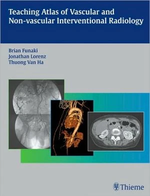 Teaching Atlas of Vascular and Non-vascular Interventional Radiology - Image 3