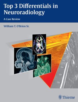 Top 3 Differentials in Neuroradiology - Image 31