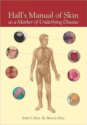 Hall's Manual of Skin As a Marker of Underlying Disease - Image 14
